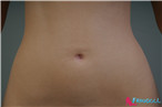 Real Skin Texture Galatea #2