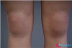 Real Skin Texture Galatea #3
