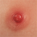 #4 Areola