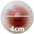 4cm